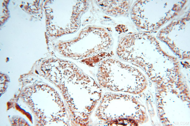 MEF2C Antibody in Immunohistochemistry (Paraffin) (IHC (P))