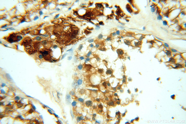 MEF2C Antibody in Immunohistochemistry (Paraffin) (IHC (P))