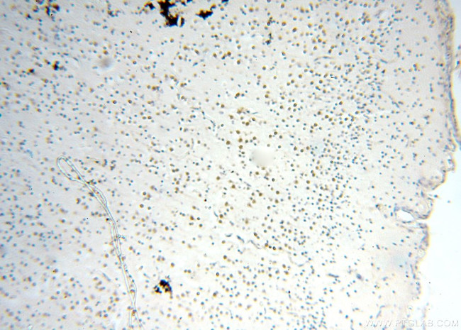 MEF2C Antibody in Immunohistochemistry (Paraffin) (IHC (P))