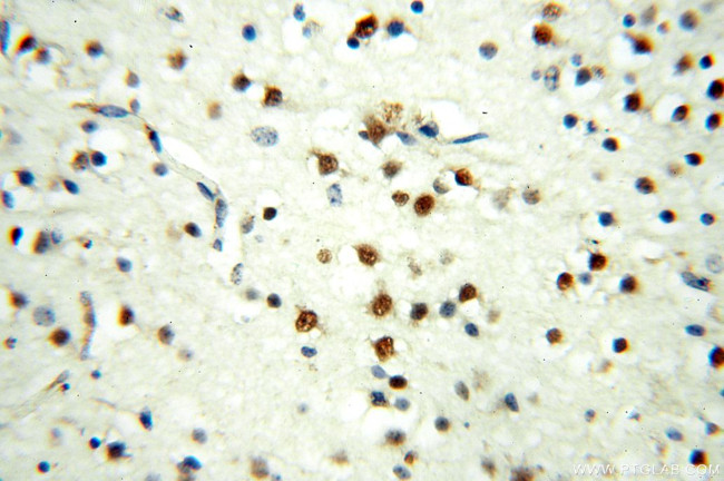 MEF2C Antibody in Immunohistochemistry (Paraffin) (IHC (P))