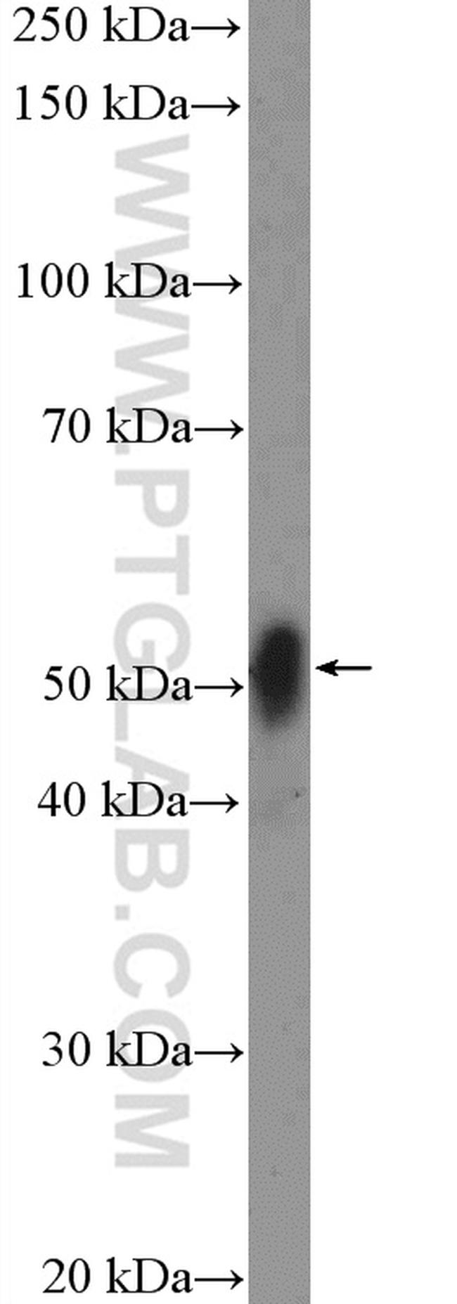 MEF2C Antibody in Western Blot (WB)