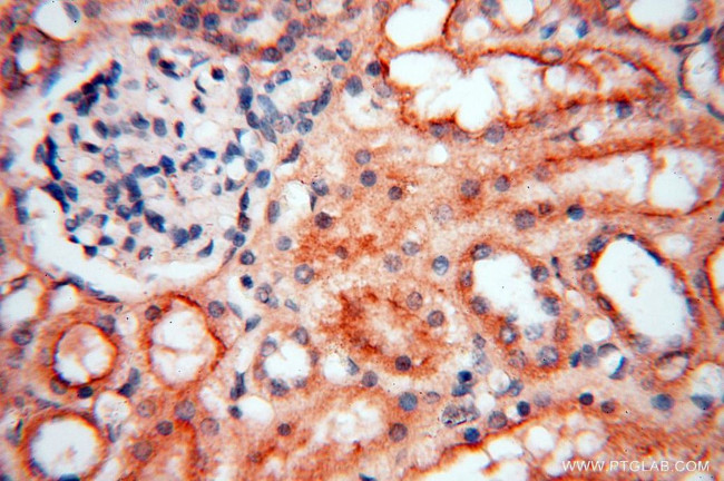 MEF2C Antibody in Immunohistochemistry (Paraffin) (IHC (P))