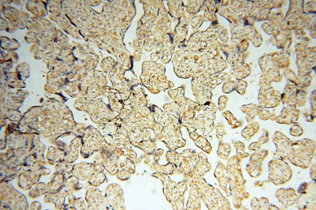 MEF2C Antibody in Immunohistochemistry (Paraffin) (IHC (P))