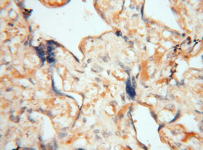 MEF2C Antibody in Immunohistochemistry (Paraffin) (IHC (P))