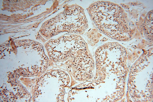 MEF2C Antibody in Immunohistochemistry (Paraffin) (IHC (P))