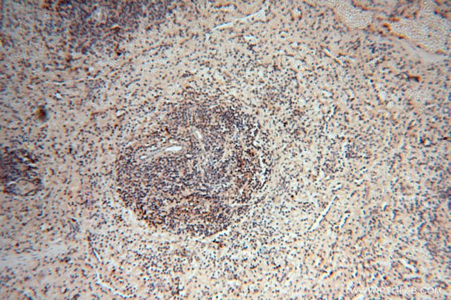 MEF2C Antibody in Immunohistochemistry (Paraffin) (IHC (P))