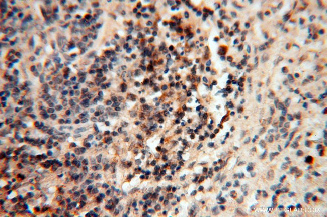 MEF2C Antibody in Immunohistochemistry (Paraffin) (IHC (P))