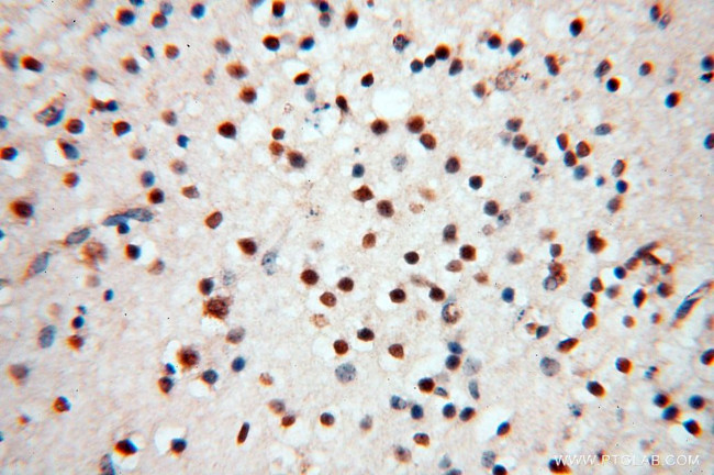 MEF2C Antibody in Immunohistochemistry (Paraffin) (IHC (P))