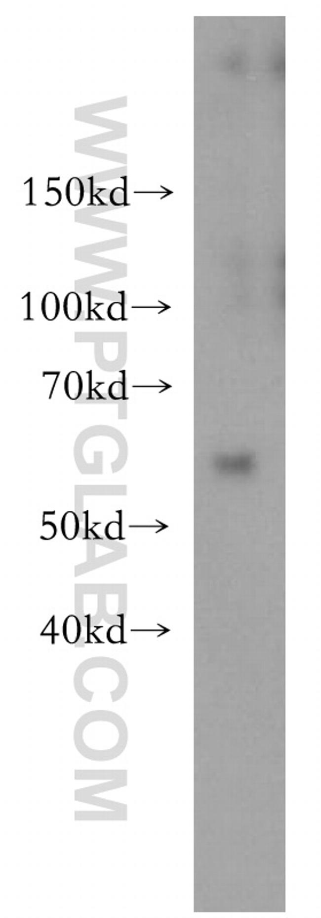 MEF2C Antibody in Western Blot (WB)