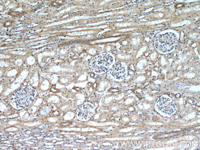 HRAS Antibody in Immunohistochemistry (Paraffin) (IHC (P))