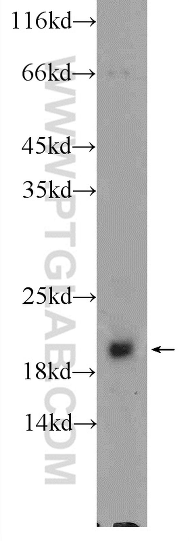 HRAS Antibody in Western Blot (WB)