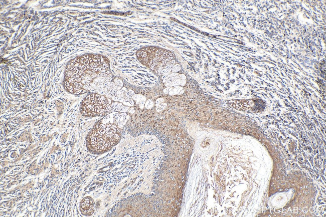 NRAS Antibody in Immunohistochemistry (Paraffin) (IHC (P))