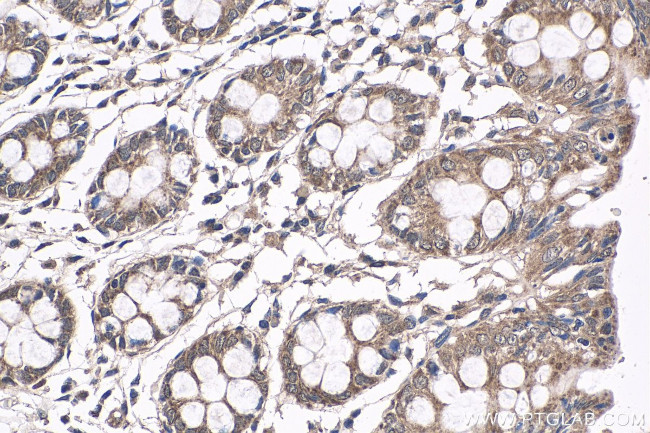 NRAS Antibody in Immunohistochemistry (Paraffin) (IHC (P))