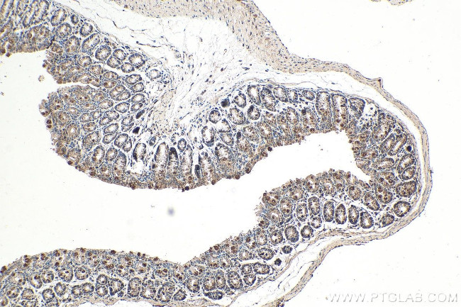 NRAS Antibody in Immunohistochemistry (Paraffin) (IHC (P))