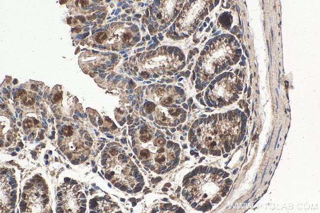 NRAS Antibody in Immunohistochemistry (Paraffin) (IHC (P))