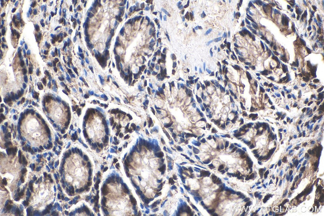 NRAS Antibody in Immunohistochemistry (Paraffin) (IHC (P))