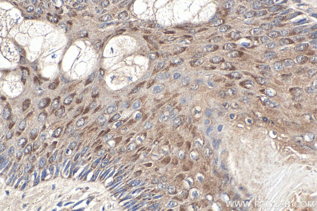 NRAS Antibody in Immunohistochemistry (Paraffin) (IHC (P))