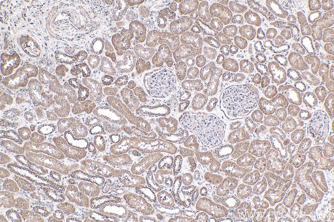 NRAS Antibody in Immunohistochemistry (Paraffin) (IHC (P))