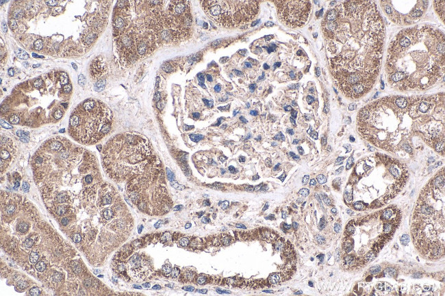 NRAS Antibody in Immunohistochemistry (Paraffin) (IHC (P))