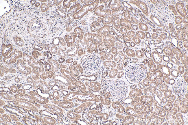 NRAS Antibody in Immunohistochemistry (Paraffin) (IHC (P))