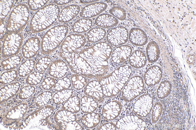 NRAS Antibody in Immunohistochemistry (Paraffin) (IHC (P))