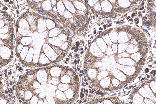 NRAS Antibody in Immunohistochemistry (Paraffin) (IHC (P))