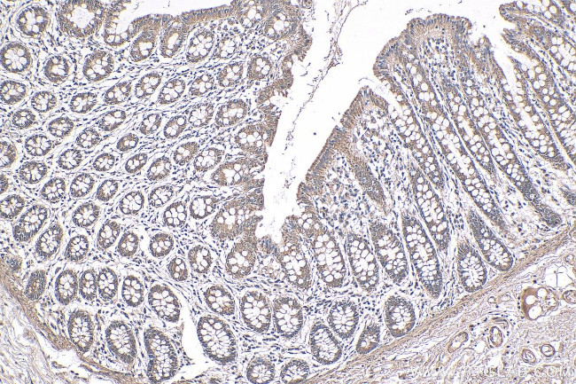 NRAS Antibody in Immunohistochemistry (Paraffin) (IHC (P))