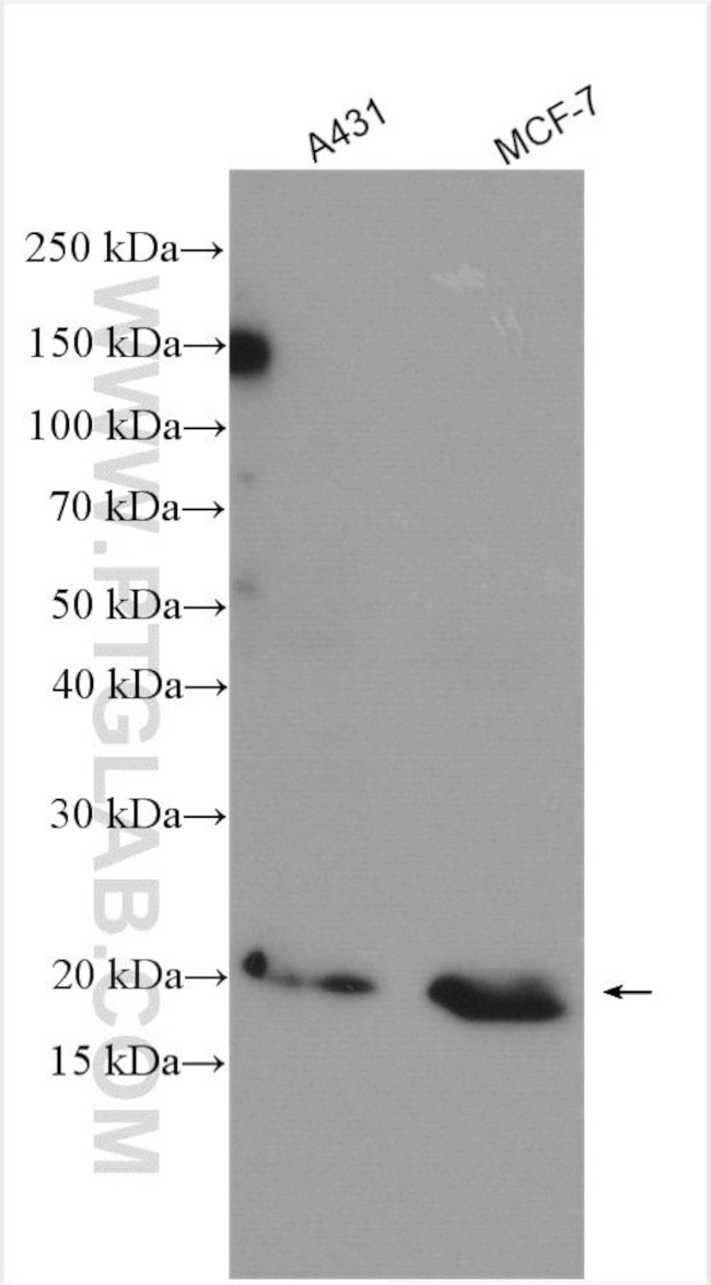 NRAS Antibody in Western Blot (WB)