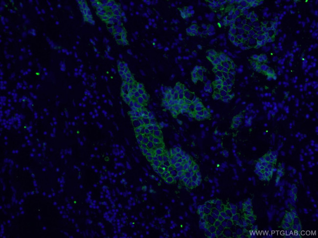 HER2/ErbB2 Antibody in Immunohistochemistry (PFA fixed) (IHC (PFA))