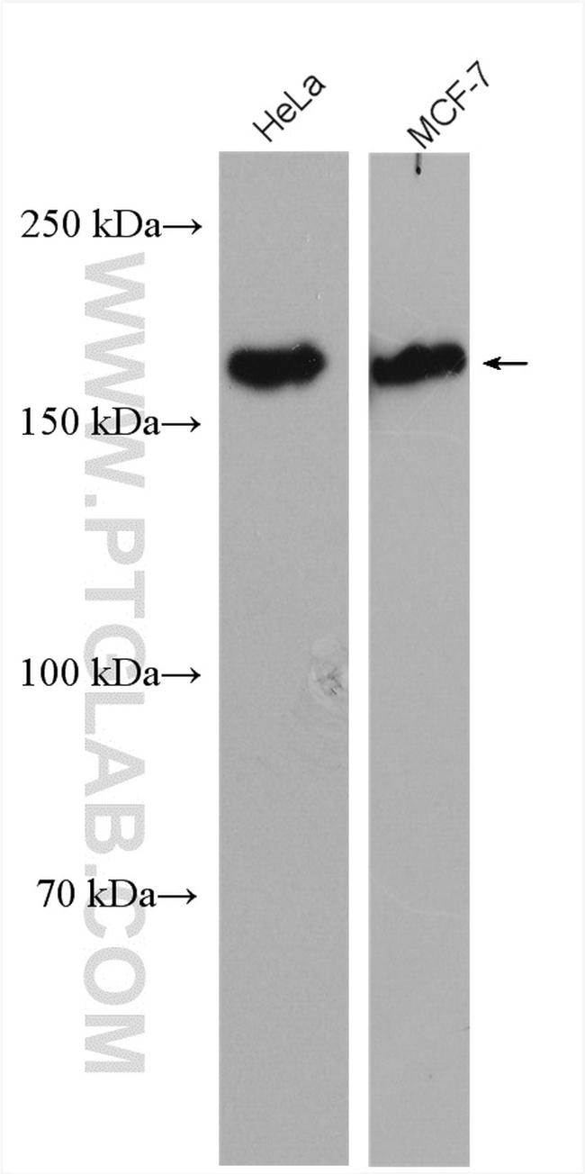 HER2/ErbB2 Antibody in Western Blot (WB)
