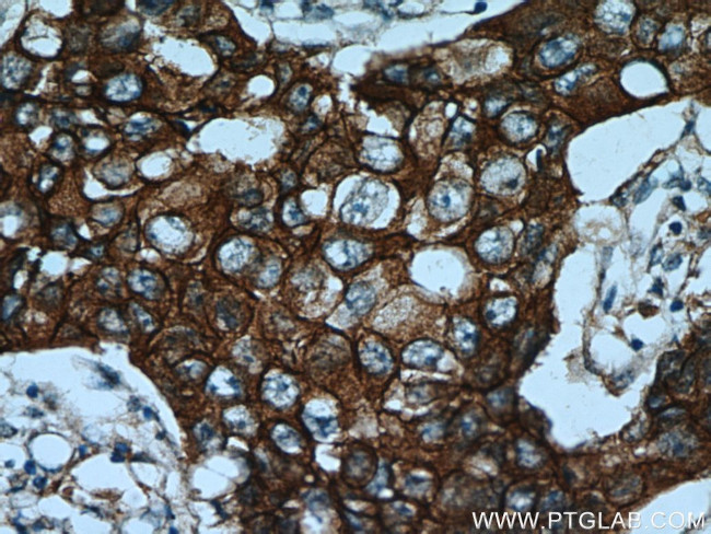 HER2/ErbB2 Antibody in Immunohistochemistry (Paraffin) (IHC (P))