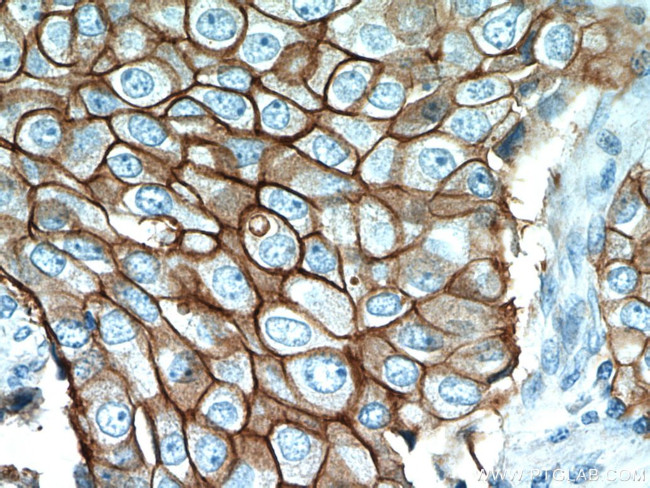 HER2/ErbB2 Antibody in Immunohistochemistry (Paraffin) (IHC (P))