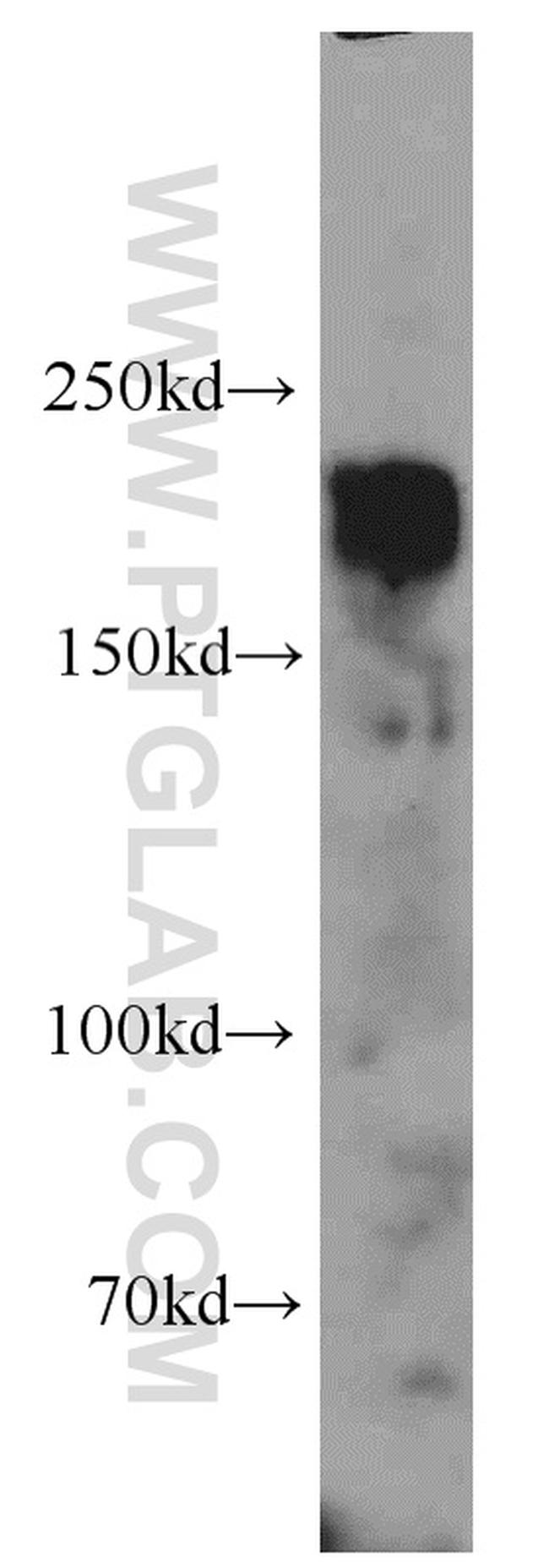 HER2/ErbB2 Antibody in Western Blot (WB)