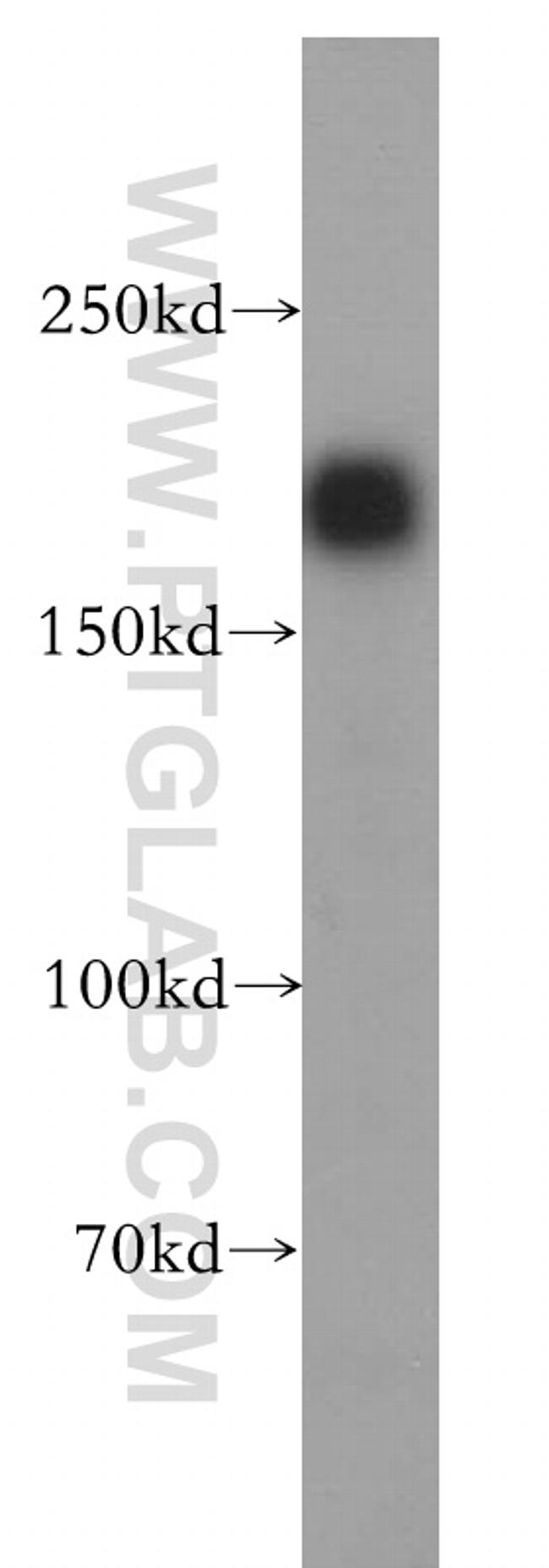 HER2/ErbB2 Antibody in Western Blot (WB)