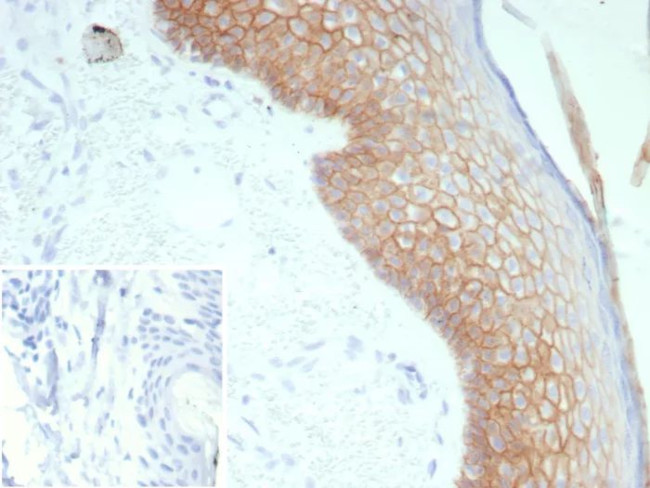 Desmoglein-3 (Squamous Cell Marker) Antibody in Immunohistochemistry (Paraffin) (IHC (P))