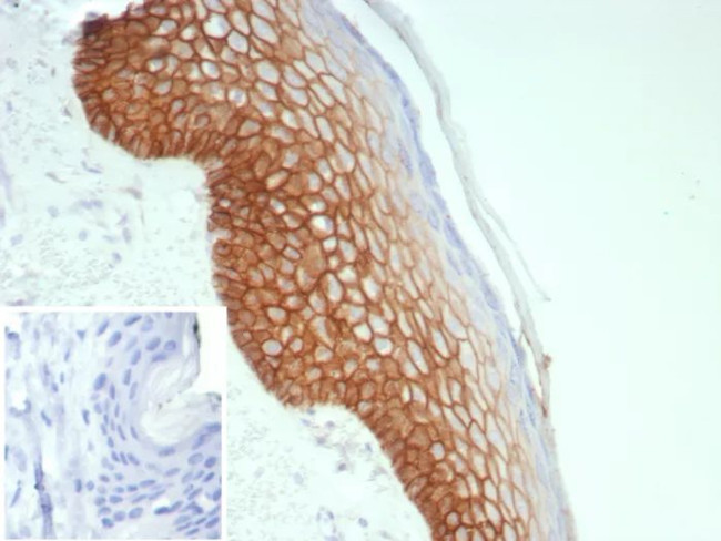 Desmoglein-3 (Squamous Cell Marker) Antibody in Immunohistochemistry (Paraffin) (IHC (P))