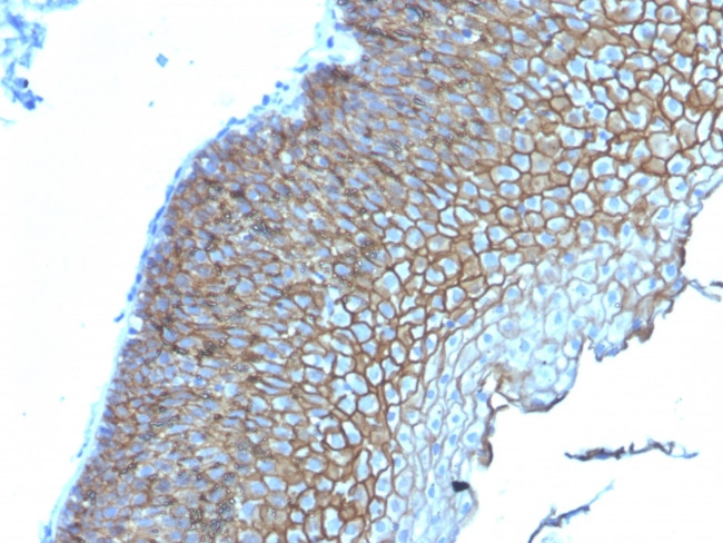 Desmoglein-3 Antibody in Immunohistochemistry (Paraffin) (IHC (P))