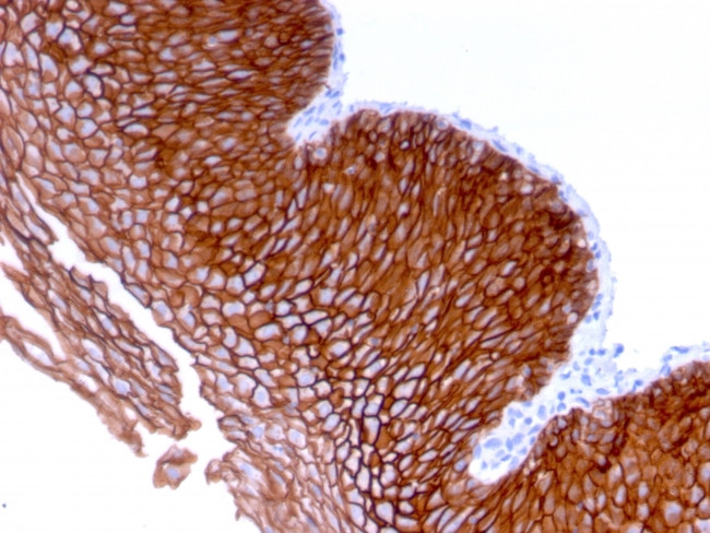 Desmoglein-3 Antibody in Immunohistochemistry (Paraffin) (IHC (P))