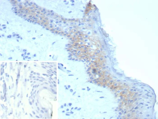 Desmoglein-3 (Squamous Cell Marker) Antibody in Immunohistochemistry (Paraffin) (IHC (P))