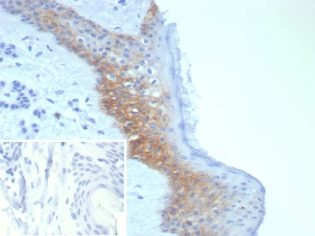 Desmoglein-3 (Squamous Cell Marker) Antibody in Immunohistochemistry (Paraffin) (IHC (P))