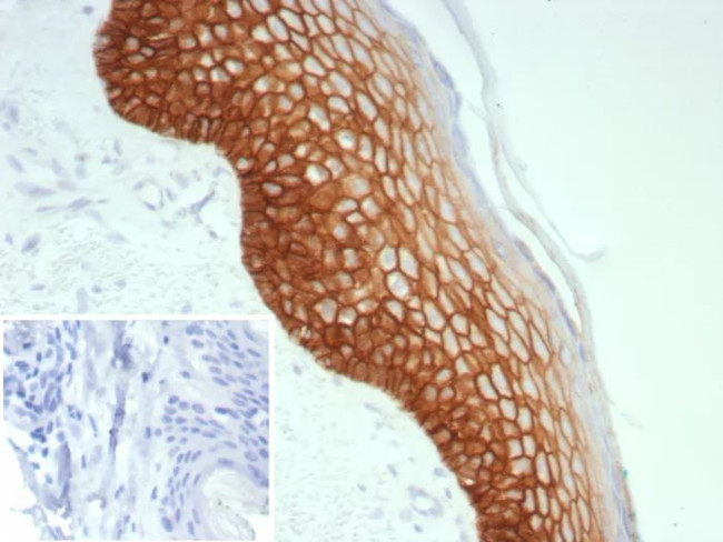 Desmoglein-3 (Squamous Cell Marker) Antibody in Immunohistochemistry (Paraffin) (IHC (P))