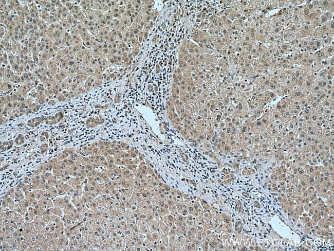 Plasminogen Antibody in Immunohistochemistry (Paraffin) (IHC (P))