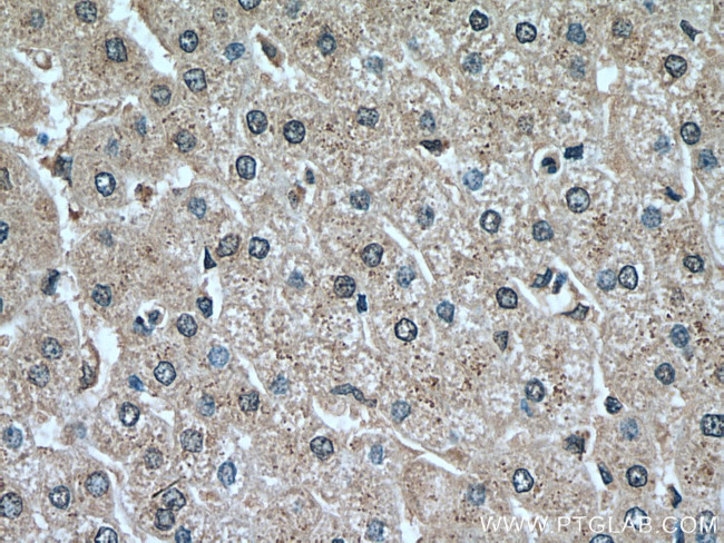 Plasminogen Antibody in Immunohistochemistry (Paraffin) (IHC (P))