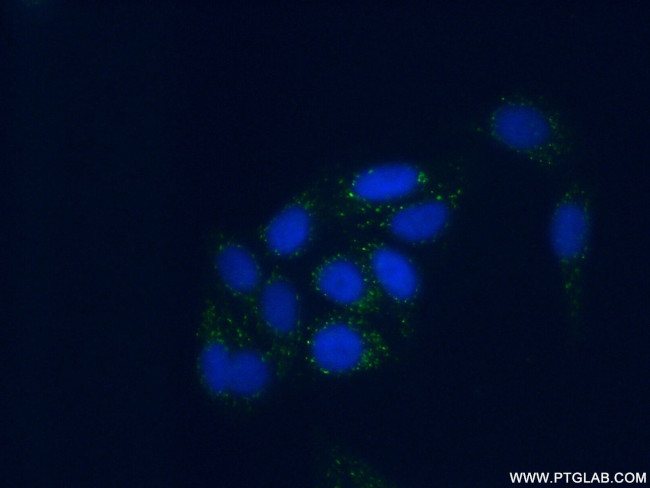 Plasminogen Antibody in Immunocytochemistry (ICC/IF)