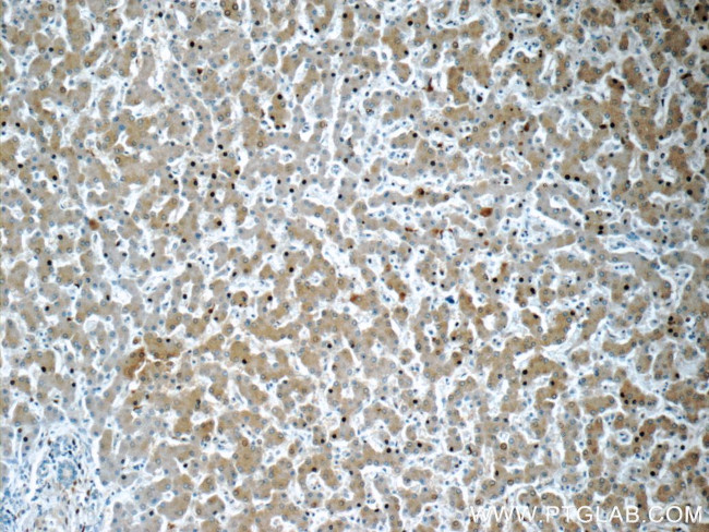 Plasminogen Antibody in Immunohistochemistry (Paraffin) (IHC (P))