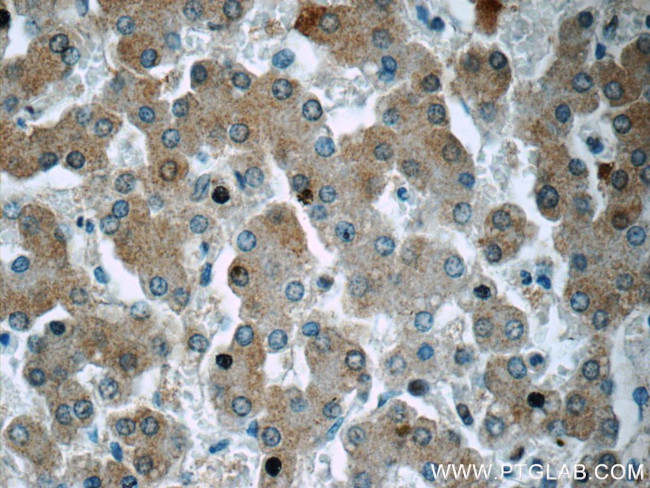 Plasminogen Antibody in Immunohistochemistry (Paraffin) (IHC (P))