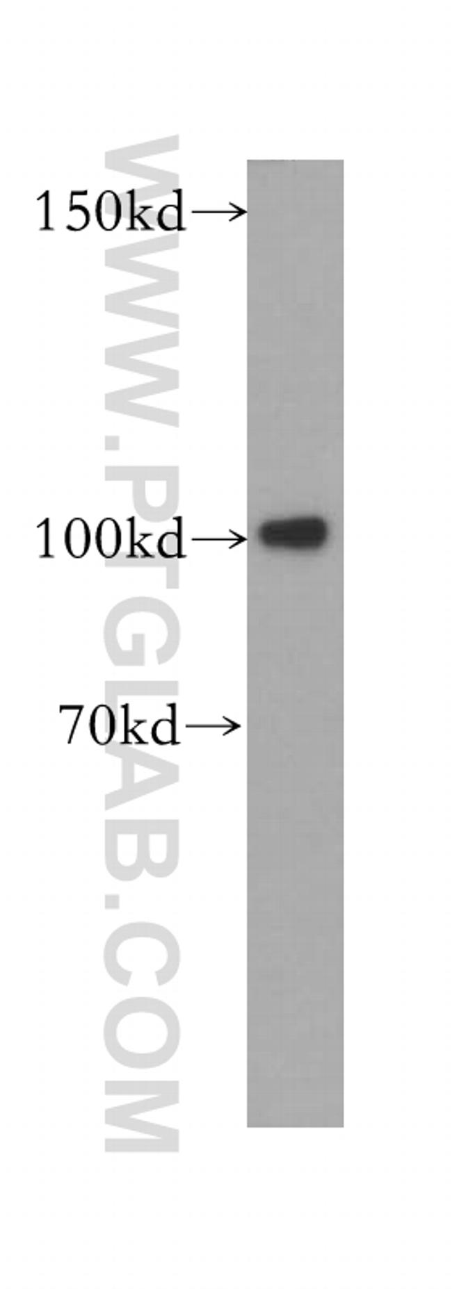 Plasminogen Antibody in Western Blot (WB)