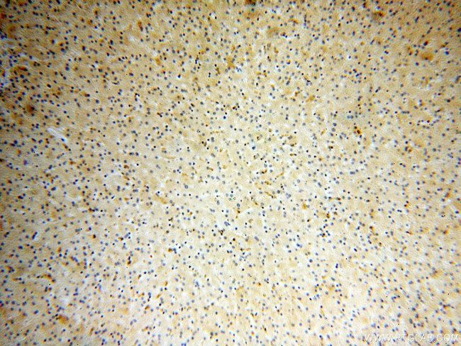 Endostatin Antibody in Immunohistochemistry (Paraffin) (IHC (P))