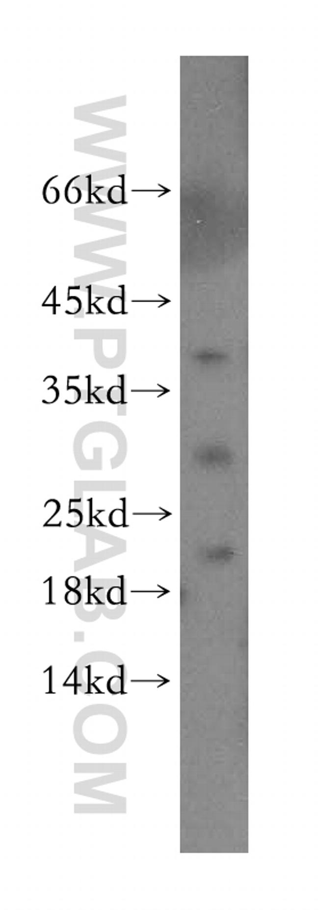 Endostatin Antibody in Western Blot (WB)