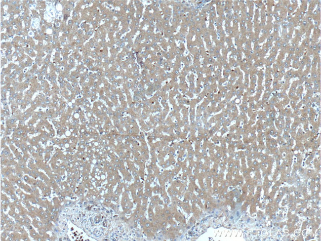 Angiogenin Antibody in Immunohistochemistry (Paraffin) (IHC (P))